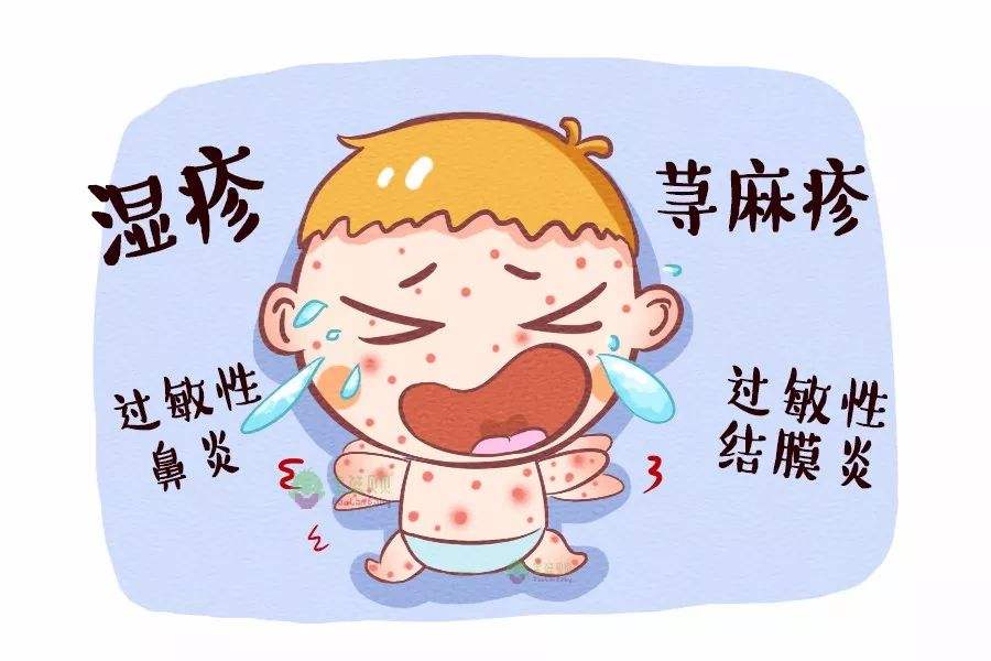 宝宝过敏育婴师实用指南